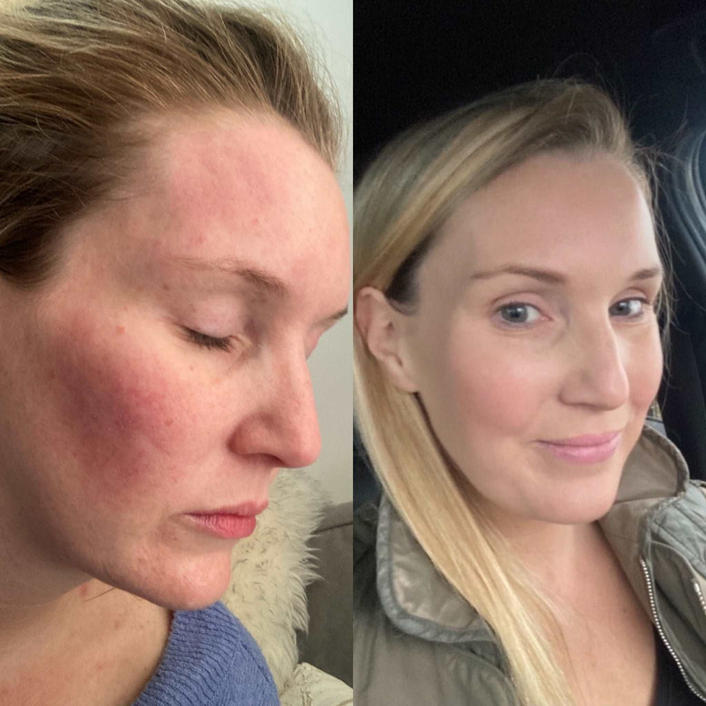 White Rabbit Skincare — Lime & Coconut 2-in-1 Makeup Remover Cleansing Water (200ml)